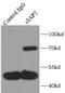 Baculoviral IAP Repeat Containing 3 antibody, FNab01706, FineTest, Immunoprecipitation image 