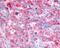 EGFR antibody, 48-394, ProSci, Immunohistochemistry frozen image 