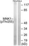 MAP kinase-interacting serine/threonine-protein kinase 1 antibody, TA313006, Origene, Western Blot image 