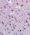 E2F-1 antibody, orb10568, Biorbyt, Immunohistochemistry paraffin image 