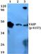 Vasodilator Stimulated Phosphoprotein antibody, A00303S157, Boster Biological Technology, Western Blot image 
