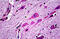 Dicer 1, Ribonuclease III antibody, MBS244505, MyBioSource, Immunohistochemistry paraffin image 