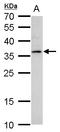 Protein lyl-1 antibody, GTX129329, GeneTex, Western Blot image 
