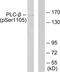 Phospholipase C Beta 3 antibody, TA314347, Origene, Western Blot image 