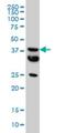 Malonyl-CoA-acyl carrier protein transacylase, mitochondrial antibody, H00027349-M01, Novus Biologicals, Western Blot image 