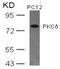 Protein kinase C delta type antibody, AP02781PU-N, Origene, Western Blot image 