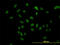 Transducin Beta Like 1 X-Linked Receptor 1 antibody, LS-C133815, Lifespan Biosciences, Immunofluorescence image 