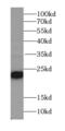 Homologous-pairing protein 2 homolog antibody, FNab03969, FineTest, Western Blot image 