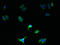 Secretory carrier-associated membrane protein 5 antibody, LS-C379067, Lifespan Biosciences, Immunofluorescence image 