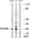 Sodium Voltage-Gated Channel Beta Subunit 4 antibody, TA326109, Origene, Western Blot image 