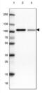 3-Hydroxy-3-Methylglutaryl-CoA Reductase antibody, NBP2-61617, Novus Biologicals, Western Blot image 
