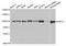 U4/U6 small nuclear ribonucleoprotein Prp3 antibody, TA332715, Origene, Western Blot image 