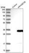 Rho Guanine Nucleotide Exchange Factor 38 antibody, PA5-57695, Invitrogen Antibodies, Western Blot image 