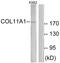 Collagen Type XI Alpha 1 Chain antibody, LS-C119467, Lifespan Biosciences, Western Blot image 