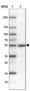 Family With Sequence Similarity 149 Member B1 antibody, NBP1-81452, Novus Biologicals, Western Blot image 