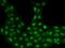 Histone-lysine N-methyltransferase SETD1B antibody, 207548-T02, Sino Biological, Immunohistochemistry paraffin image 