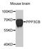 Serine/threonine-protein phosphatase 2B catalytic subunit beta isoform antibody, MBS128626, MyBioSource, Western Blot image 