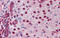 Nuclear Receptor Subfamily 0 Group B Member 2 antibody, 26-064, ProSci, Immunohistochemistry paraffin image 