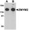 Zinc Finger MYM-Type Containing 2 antibody, A04648, Boster Biological Technology, Western Blot image 