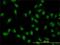 XPA Binding Protein 2 antibody, H00056949-M01, Novus Biologicals, Immunofluorescence image 