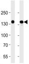 Fms Related Tyrosine Kinase 4 antibody, GTX17567, GeneTex, Western Blot image 