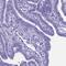 Creatine kinase M-type antibody, HPA047859, Atlas Antibodies, Immunohistochemistry paraffin image 
