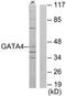 GATA Binding Protein 4 antibody, TA326262, Origene, Western Blot image 
