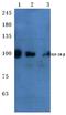 Insulin Like Growth Factor 1 Receptor antibody, AP06178PU-N, Origene, Western Blot image 