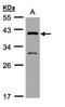 GIPC PDZ Domain Containing Family Member 3 antibody, NBP1-31178, Novus Biologicals, Western Blot image 