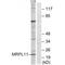 Mitochondrial Ribosomal Protein L11 antibody, A11059, Boster Biological Technology, Western Blot image 