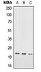 RAB29, Member RAS Oncogene Family antibody, LS-C353106, Lifespan Biosciences, Western Blot image 