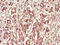 F-Box And Leucine Rich Repeat Protein 22 antibody, CSB-PA757543LA01HU, Cusabio, Immunohistochemistry paraffin image 