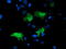 Low Density Lipoprotein Receptor Adaptor Protein 1 antibody, LS-C173477, Lifespan Biosciences, Immunofluorescence image 