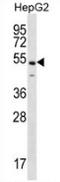 NFKB Activating Protein antibody, AP52884PU-N, Origene, Western Blot image 