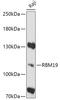 RNA Binding Motif Protein 19 antibody, 16-998, ProSci, Western Blot image 