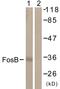 FosB Proto-Oncogene, AP-1 Transcription Factor Subunit antibody, LS-C822350, Lifespan Biosciences, Western Blot image 