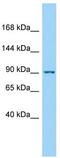 Protein Kinase N1 antibody, TA334480, Origene, Western Blot image 