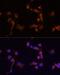 ABL Proto-Oncogene 1, Non-Receptor Tyrosine Kinase antibody, LS-B13844, Lifespan Biosciences, Immunofluorescence image 