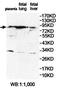 Prolyl 3-hydroxylase 2 antibody, orb78379, Biorbyt, Western Blot image 