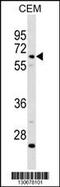 Complement component C8 beta chain antibody, 60-701, ProSci, Western Blot image 