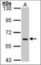 YES Proto-Oncogene 1, Src Family Tyrosine Kinase antibody, orb89486, Biorbyt, Western Blot image 