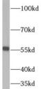 RNA Guanine-7 Methyltransferase antibody, FNab07367, FineTest, Western Blot image 