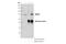 Mitogen-Activated Protein Kinase Kinase Kinase 2 antibody, 19607S, Cell Signaling Technology, Immunoprecipitation image 