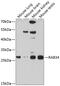 Ras-related protein Rab-34 antibody, GTX65558, GeneTex, Western Blot image 