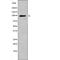 Leptin Receptor antibody, PA5-64638, Invitrogen Antibodies, Western Blot image 