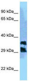 Phosphoglycolate Phosphatase antibody, TA343268, Origene, Western Blot image 