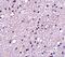 NK3R antibody, GTX31316, GeneTex, Immunohistochemistry paraffin image 
