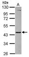 Makorin Ring Finger Protein 2 antibody, NBP2-17301, Novus Biologicals, Western Blot image 