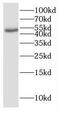 Growth Hormone Releasing Hormone Receptor antibody, FNab03451, FineTest, Western Blot image 