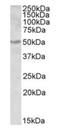 Aldehyde Dehydrogenase 9 Family Member A1 antibody, orb20592, Biorbyt, Western Blot image 